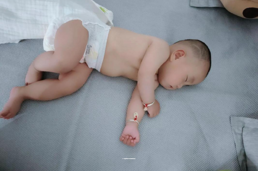 渭南宝宝头上长痱子